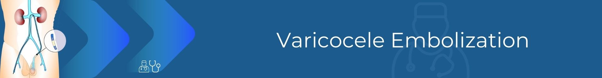 Varicocele Embolization